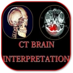 ct brain basic interpretation android application logo